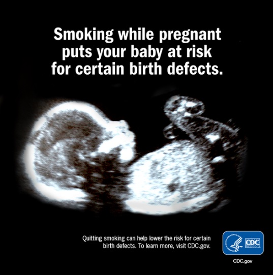سیگار بارداری و زایمان در مادری که سیگار می کشد.